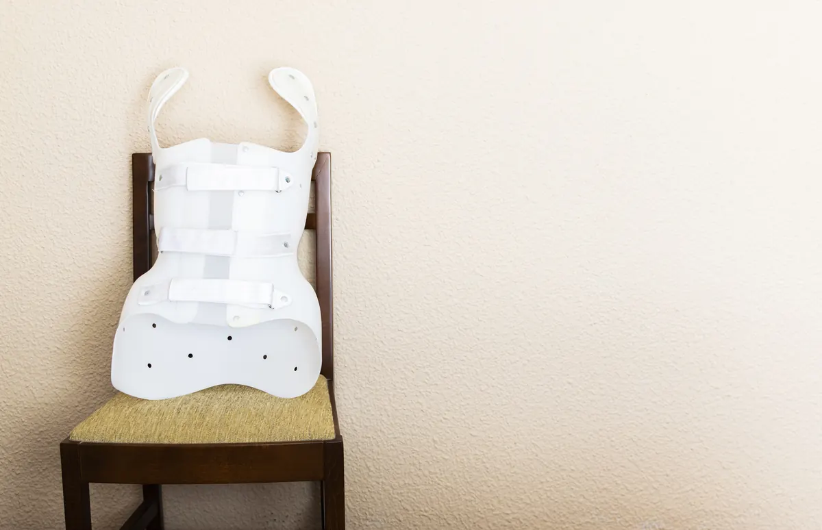 Custom Boston-style spinal orthosis fitted for scoliosis correction.