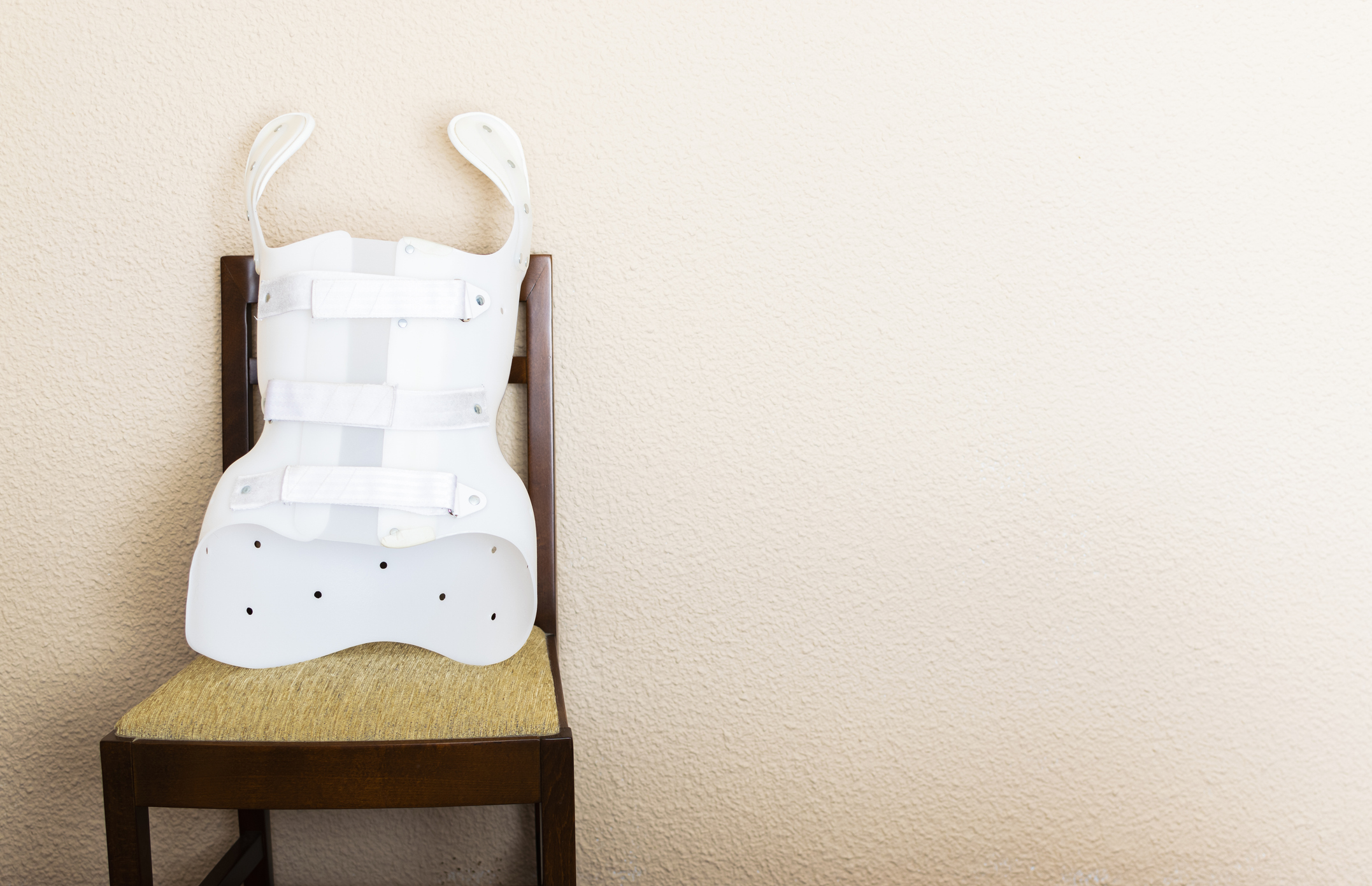 Custom spinal orthosis &mdash; the kind of asymmetrical, three-plane brace GOSS specializes in.